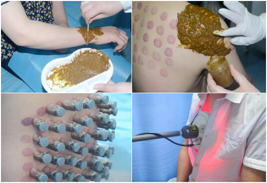 万象城平台_万象城（中国）一站式服务平台,：向中医药看齐，与世界共享中医药文化(图4)